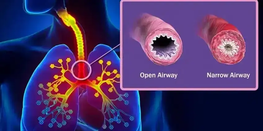 Respiratory Problems - Biomagnetism therapy